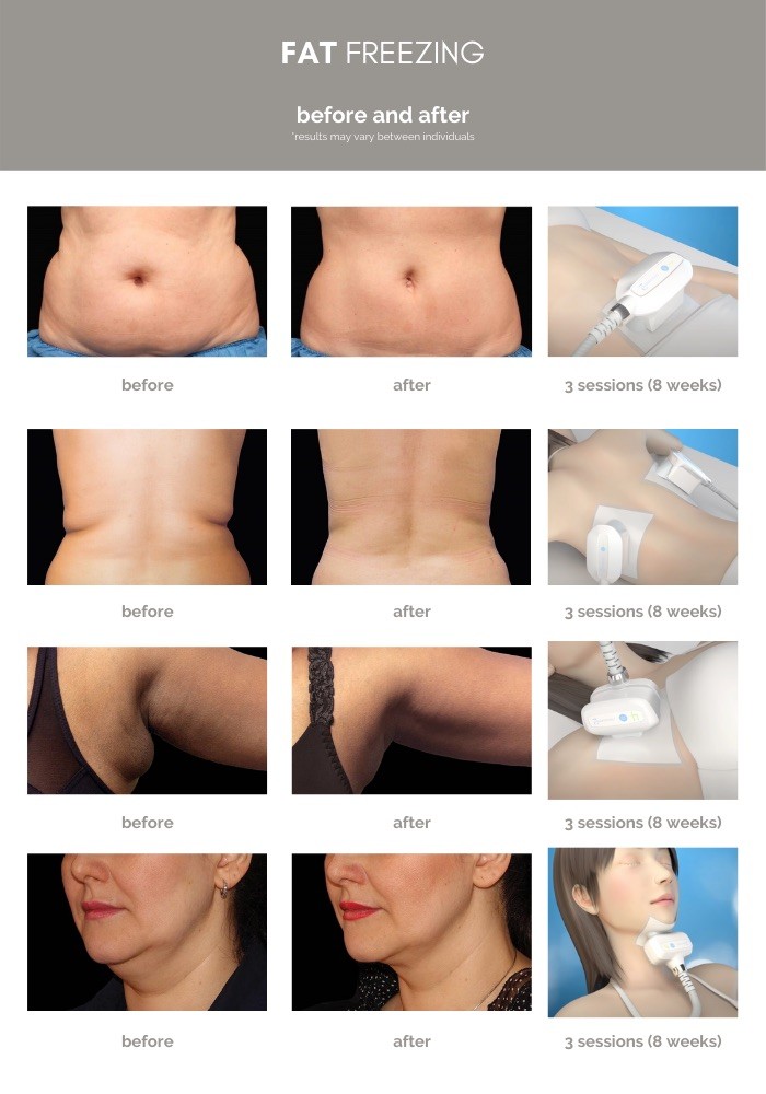 Copy of Bio Aesthetic Article Infographic